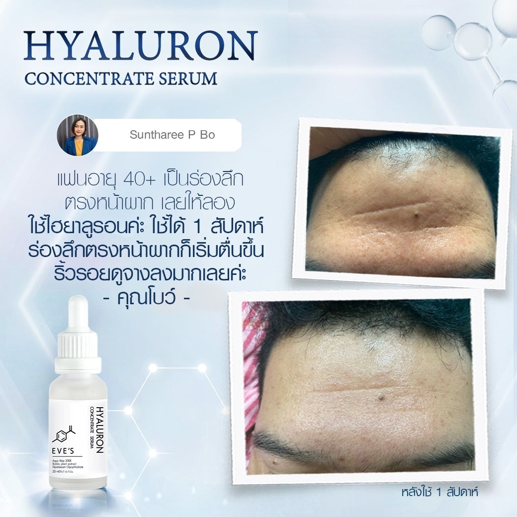 EVES อีฟส์ ไฮยาลูรอน HYALURON CONCENTRATE SERUM คอนเซ็นเทรท เซรั่ม เติมเต็มความชุ่มชื้นให้ผิว ริ้วรอยดูตื้นขึ้น