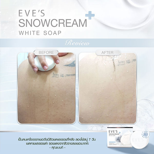 EVES อีฟส์ สบู่อีฟส์ SNOWCREAM WHITE SOAP ลดสิว ผิวขาว ฆ่าเชื้อไวรัส (ANTI BACTERIAL 99.99%)